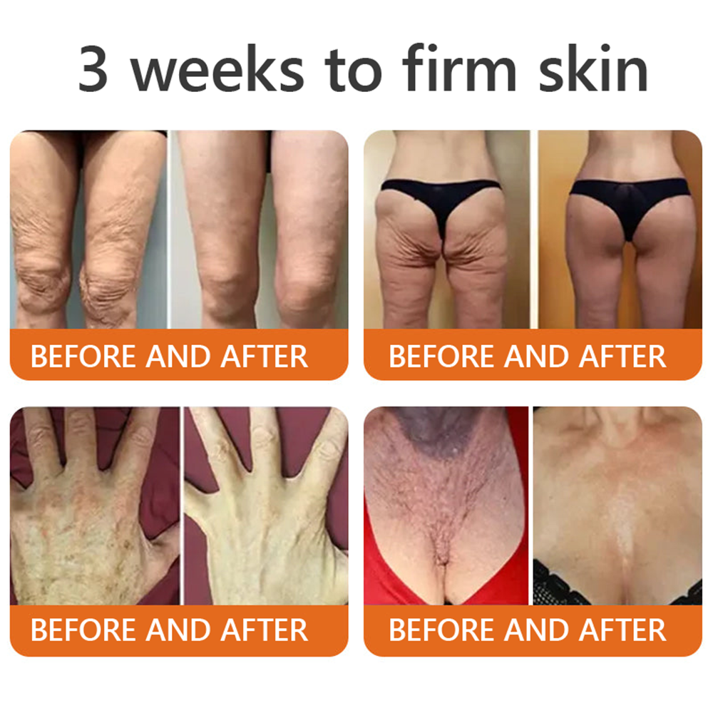 𝐌𝐚𝐝𝐞 𝐢𝐧 𝐁𝐫𝐢𝐭𝐚𝐢𝐧 👩⚕️𝗧𝗟𝗢𝗣𝗔® Botox Bee Venom Firming Serum Stick🎁Firm Skin, Defy Aging 🤍🤍