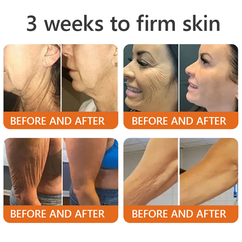 𝐌𝐚𝐝𝐞 𝐢𝐧 𝐁𝐫𝐢𝐭𝐚𝐢𝐧 👩⚕️𝗧𝗟𝗢𝗣𝗔® Botox Bee Venom Firming Serum Stick🎁Firm Skin, Defy Aging 🤍🤍