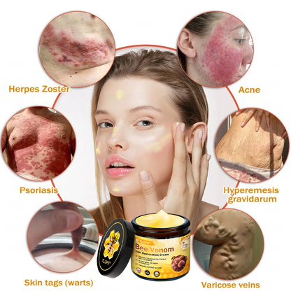 MHRA Approved: TLOPA® Bee Venom Skin Restoration Cream — 🔥Limited Time 80% OFF🔥