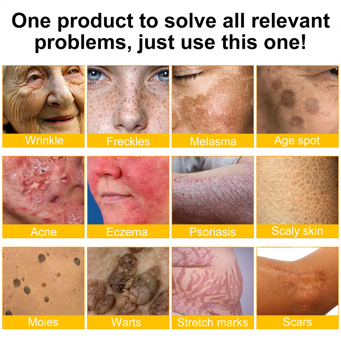 MHRA Approved: TLOPA® Bee Venom Skin Restoration Cream — 🔥Limited Time 80% OFF🔥