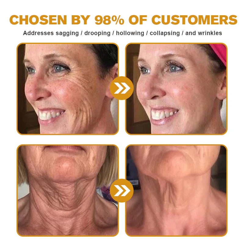 MHRA Approved: TLOPA® Bee Venom Skin Restoration Cream — 🔥Limited Time 80% OFF🔥