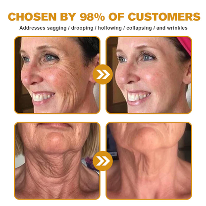 MHRA Approved: TLOPA® Bee Venom Skin Restoration Cream — 🔥Limited Time 80% OFF🔥