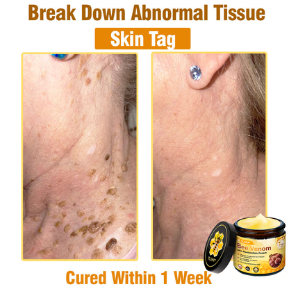 MHRA Approved: TLOPA® Bee Venom Skin Restoration Cream — 🔥Limited Time 80% OFF🔥