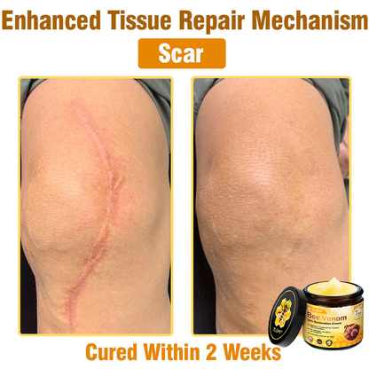 MHRA Approved: TLOPA® Bee Venom Skin Restoration Cream — 🔥Limited Time 80% OFF🔥
